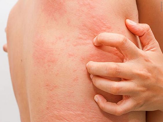 10 Causes Of Red Spots On Skin That Itch Health2Wellness Blog